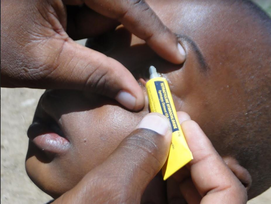 Child getting trachoma eye shot